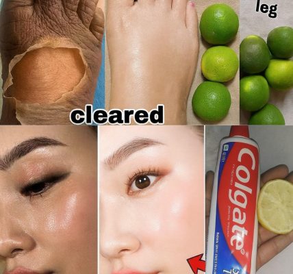 🌟 Glow Up or Myth? The Truth About Lemon and Colgate for Brighter Skin 🌟 Glow Up or Myth? The Truth About Lemon and Colgate for Brighter Skin