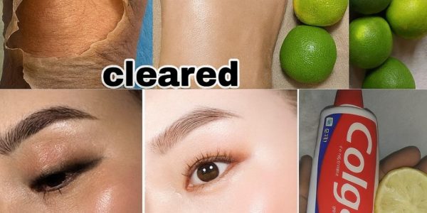 🌟 Glow Up or Myth? The Truth About Lemon and Colgate for Brighter Skin 🌟 Glow Up or Myth? The Truth About Lemon and Colgate for Brighter Skin