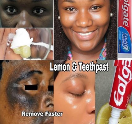 https://healthformula.alodi.net/%F0%9F%8C%9F-the-truth-about-lemon-and-colgate-for-brighter-skin-myth-or-miracle/ https://healthformula.alodi.net/%F0%9F%8C%9F-the-truth-about-lemon-and-colgate-for-brighter-skin-myth-or-miracle/