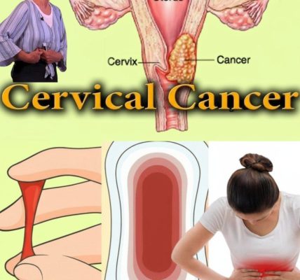 🚨 Is Your Uterus Sending an SOS? 12 Warning Signs You Can’t Ignore 🚨 Is Your Uterus Sending an SOS? 12 Warning Signs You Can’t Ignore