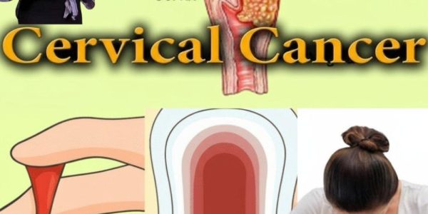 🚨 Is Your Uterus Sending an SOS? 12 Warning Signs You Can’t Ignore 🚨 Is Your Uterus Sending an SOS? 12 Warning Signs You Can’t Ignore