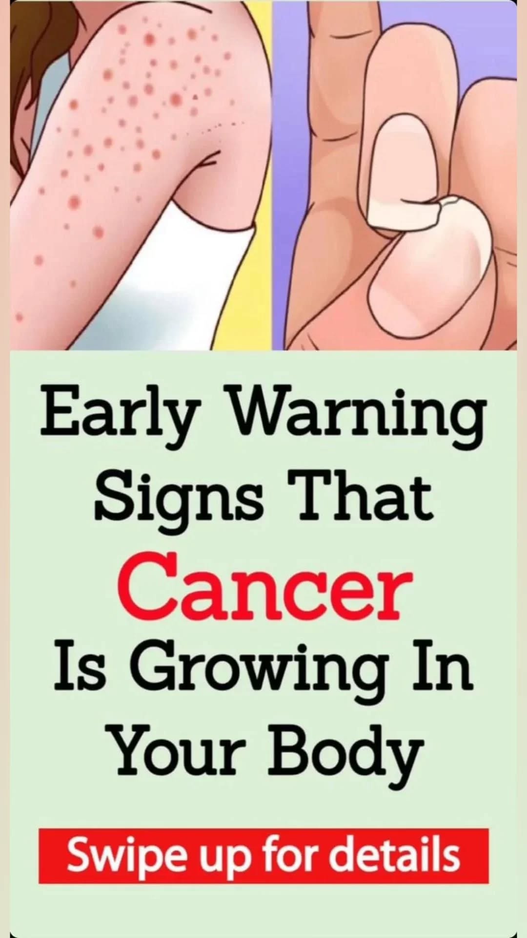 19 Early Warning Signs Your Body Might Be Showing About Cancer 19 Early Warning Signs Your Body Might Be Showing About Cancer