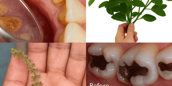 How Holy Basil (Tulsi) Transforms Your Oral Health! 🦷