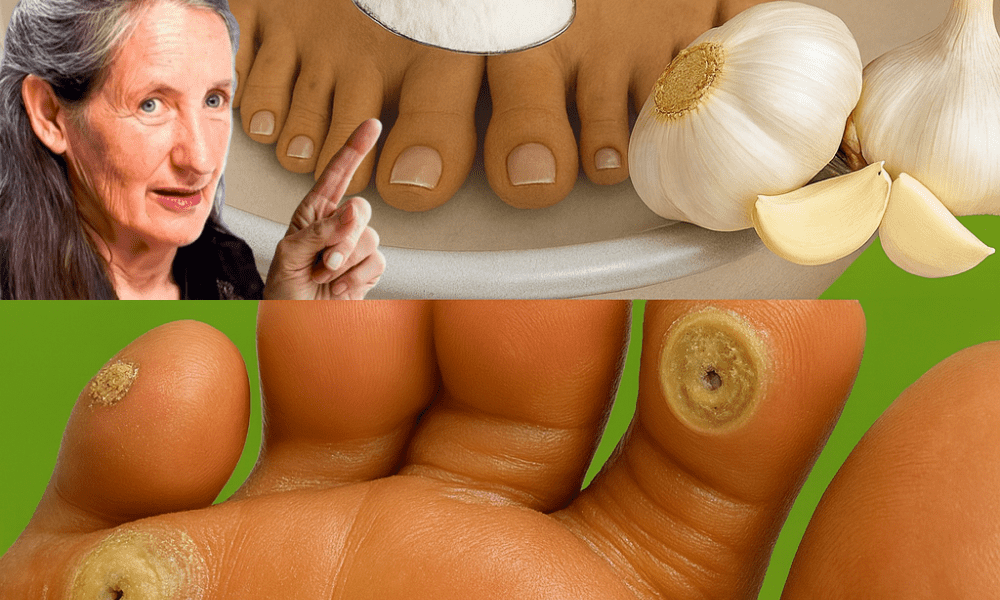 https://healthformula.alodi.net/%F0%9F%A7%84-zap-plantar-warts-away-with-garlic-natures-secret-weapon/