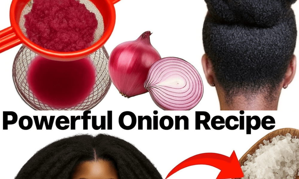 🌿 Unlock the Secret to Thicker Hair: What Onion Juice Can Do for Your Scalp in Just 7 Days 🌿 Unlock the Secret to Thicker Hair: What Onion Juice Can Do for Your Scalp in Just 7 Days