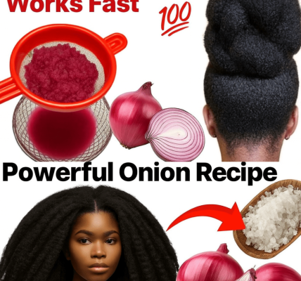 🌿 Unlock the Secret to Thicker Hair: What Onion Juice Can Do for Your Scalp in Just 7 Days 🌿 Unlock the Secret to Thicker Hair: What Onion Juice Can Do for Your Scalp in Just 7 Days