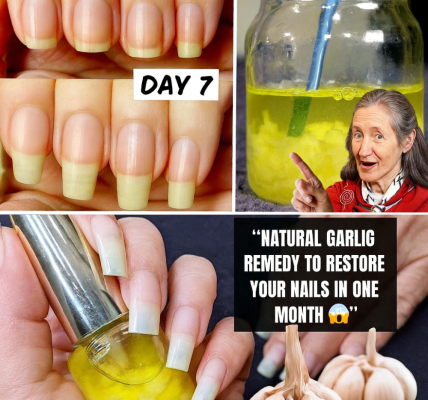 🌟 Unlock Stunning Nails in 30 Days: The Garlic Secret You’ll Wish You Knew Sooner 🌟 Unlock Stunning Nails in 30 Days: The Garlic Secret You’ll Wish You Knew Sooner