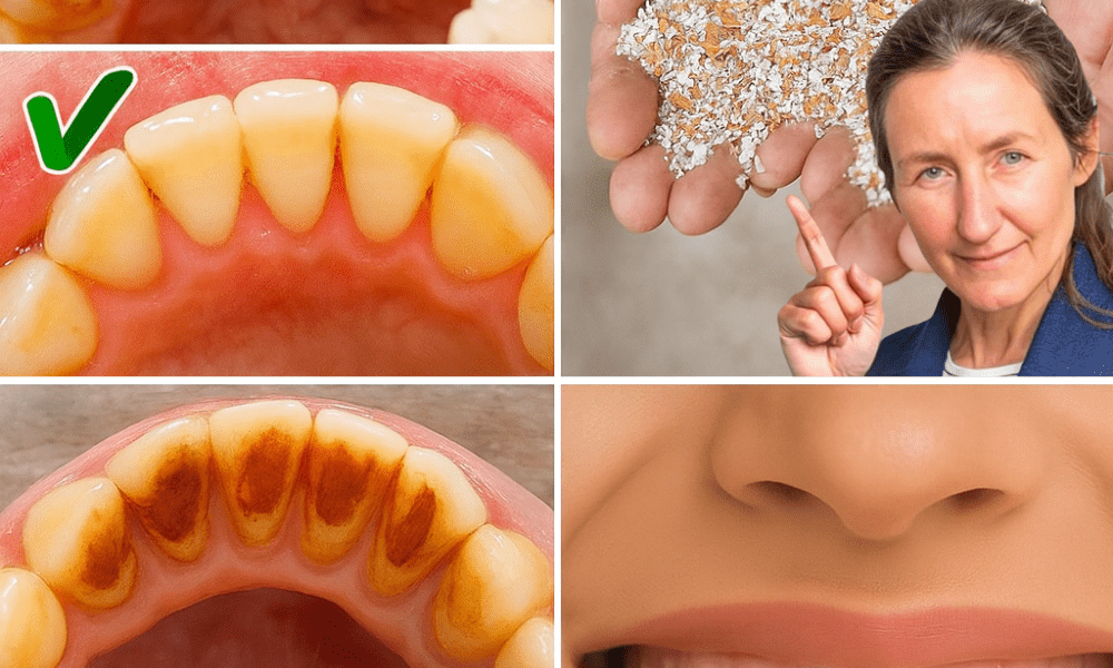 The Secret to a Dazzling Smile Is Hiding in Your Trash: Unlock Eggshells’ Power for Whiter, Stronger Teeth