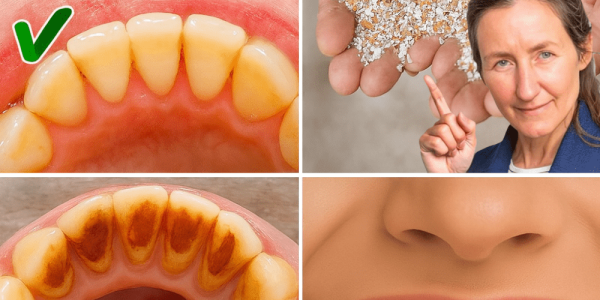 The Secret to a Dazzling Smile Is Hiding in Your Trash: Unlock Eggshells’ Power for Whiter, Stronger Teeth The Secret to a Dazzling Smile Is Hiding in Your Trash: Unlock Eggshells’ Power for Whiter, Stronger Teeth