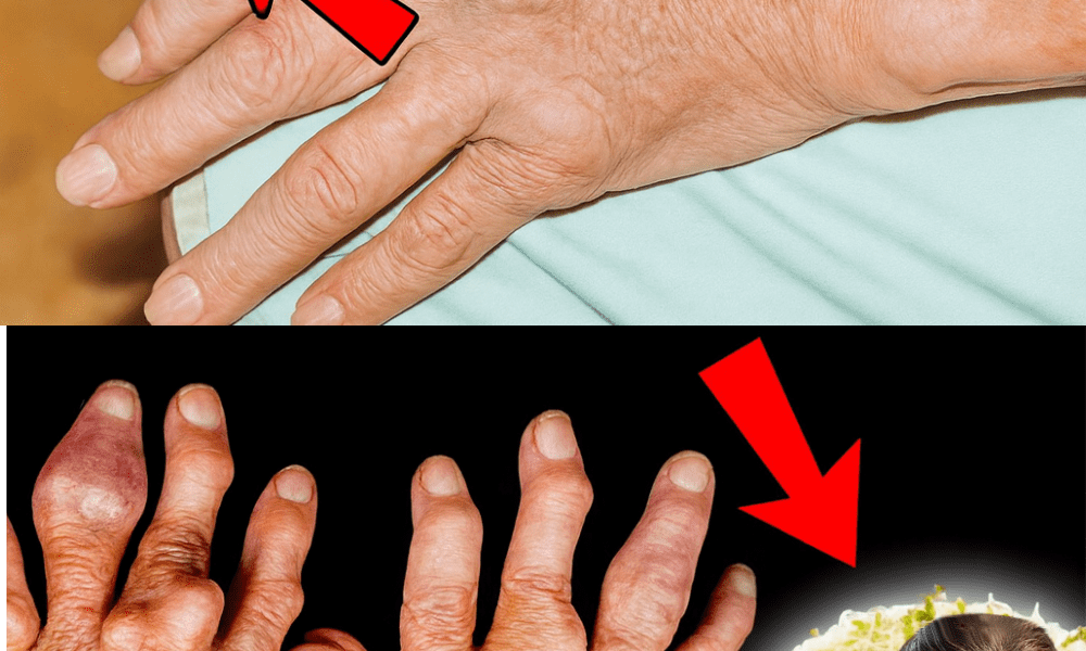 đż Unlock the Hidden Power of Alfalfa: Your Natural Ally Against Kidney Stones and Gout đż Unlock the Hidden Power of Alfalfa: Your Natural Ally Against Kidney Stones and Gout