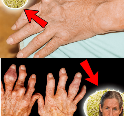 🌿 Unlock the Hidden Power of Alfalfa: Your Natural Ally Against Kidney Stones and Gout 🌿 Unlock the Hidden Power of Alfalfa: Your Natural Ally Against Kidney Stones and Gout