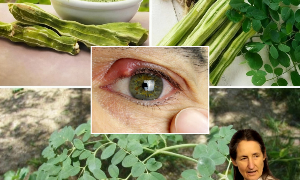 šæ Unleash the Power of Moringa: The Miracle Tree That Transforms Your Health šæ Unleash the Power of Moringa: The Miracle Tree That Transforms Your Health