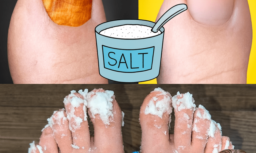 đ Say Goodbye to Nail Fungus: The Natural Remedy That Restores Your Confidence đ Say Goodbye to Nail Fungus: The Natural Remedy That Restores Your Confidence