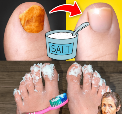 🌟 Say Goodbye to Nail Fungus: The Natural Remedy That Restores Your Confidence 🌟 Say Goodbye to Nail Fungus: The Natural Remedy That Restores Your Confidence