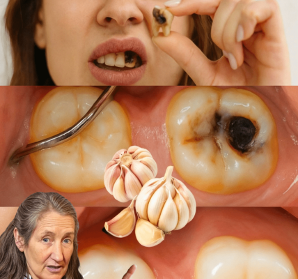 𦷠The Hidden Power of Garlic: Can This Kitchen Staple Help Heal Cavities Naturally? 𦷠The Hidden Power of Garlic: Can This Kitchen Staple Help Heal Cavities Naturally?