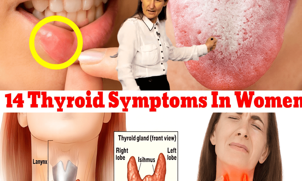 🚨 14 Thyroid Symptoms in Women You Can’t Afford to Ignore 🚨 14 Thyroid Symptoms in Women You Can’t Afford to Ignore
