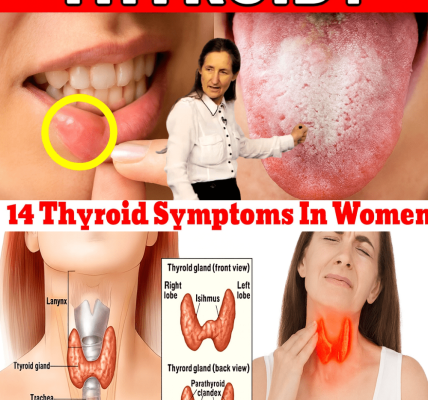 🚨 14 Thyroid Symptoms in Women You Can’t Afford to Ignore 🚨 14 Thyroid Symptoms in Women You Can’t Afford to Ignore