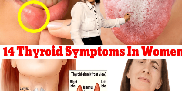 🚨 14 Thyroid Symptoms in Women You Can’t Afford to Ignore 🚨 14 Thyroid Symptoms in Women You Can’t Afford to Ignore