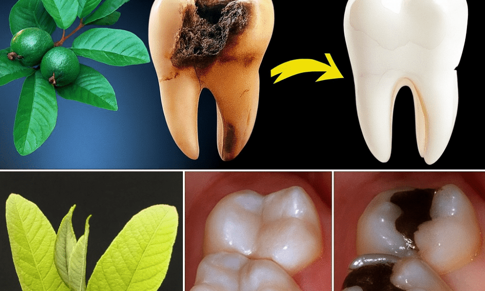 šæ Guava Leaves: Natureās Secret Weapon Against Tooth Decay šæ Guava Leaves: Natureās Secret Weapon Against Tooth Decay