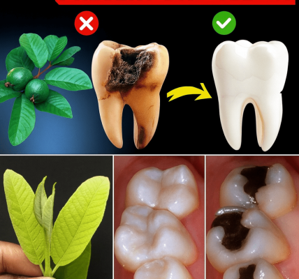 🌿 Guava Leaves: Nature’s Secret Weapon Against Tooth Decay 🌿 Guava Leaves: Nature’s Secret Weapon Against Tooth Decay