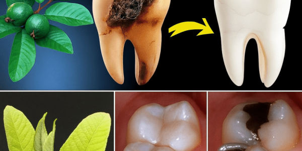 🌿 Guava Leaves: Nature’s Secret Weapon Against Tooth Decay 🌿 Guava Leaves: Nature’s Secret Weapon Against Tooth Decay