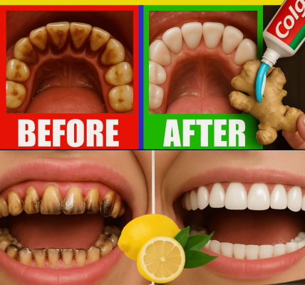 😁 Unlock a Dazzling Smile Naturally: 11 Secrets to Whiter Teeth Without Bleach 😁 Unlock a Dazzling Smile Naturally: 11 Secrets to Whiter Teeth Without Bleach