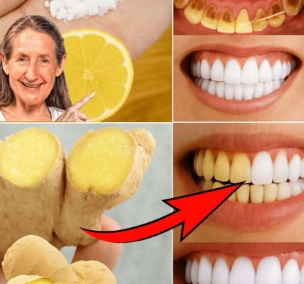 The Surprising Power of Ginger and Baking Soda for a Radiant Smile The Surprising Power of Ginger and Baking Soda for a Radiant Smile