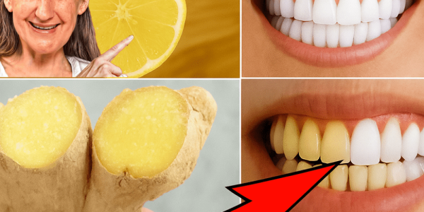 The Surprising Power of Ginger and Baking Soda for a Radiant Smile The Surprising Power of Ginger and Baking Soda for a Radiant Smile