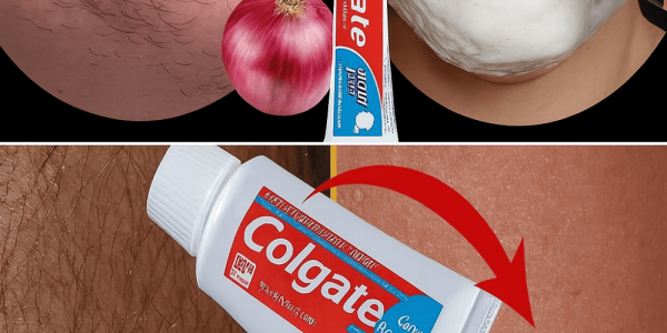 Transform Your Skin with This Toothpaste and Onion Ritual Transform Your Skin with This Toothpaste and Onion Ritual