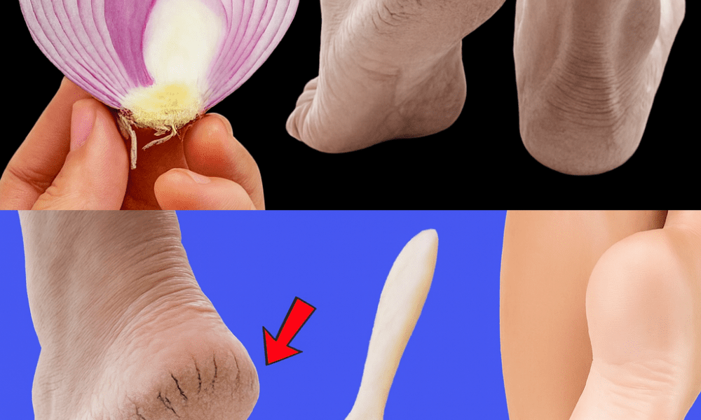 5 Kitchen Remedies That Truly Heal 5 Kitchen Remedies That Truly Heal