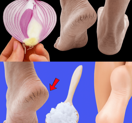 5 Kitchen Remedies That Truly Heal 5 Kitchen Remedies That Truly Heal