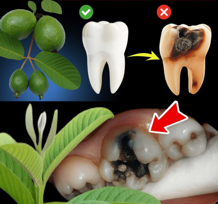 The Secret to Banishing Tooth Decay Naturally The Secret to Banishing Tooth Decay Naturally