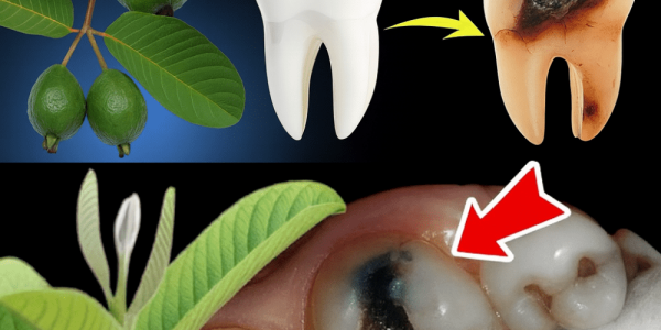 The Secret to Banishing Tooth Decay Naturally The Secret to Banishing Tooth Decay Naturally