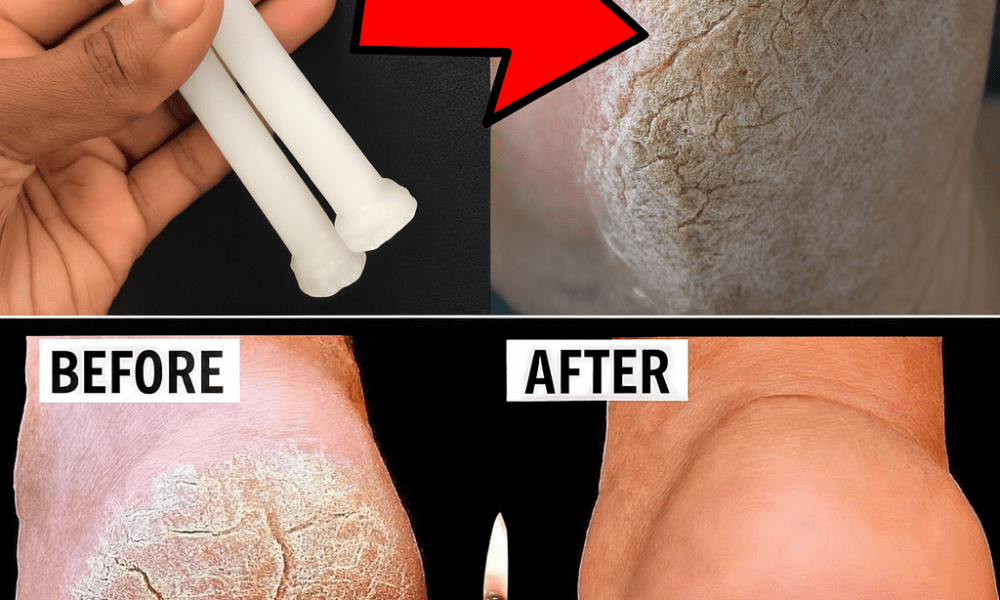 The Surprising Candle Wax Hack for Silky-Smooth Heels The Surprising Candle Wax Hack for Silky-Smooth Heels