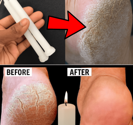 The Surprising Candle Wax Hack for Silky-Smooth Heels