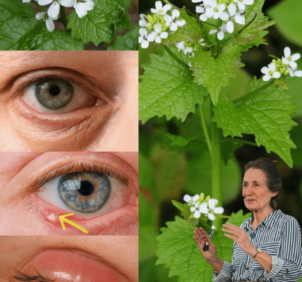 🌿 Discover the Hidden Superfood in Your Backyard: Garlic Mustard’s 20 Astonishing Benefits 🌿 Discover the Hidden Superfood in Your Backyard: Garlic Mustard’s 20 Astonishing Benefits
