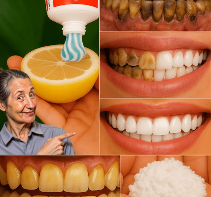 The Lemon and Baking Soda Secret to Sparkling Teeth The Lemon and Baking Soda Secret to Sparkling Teeth
