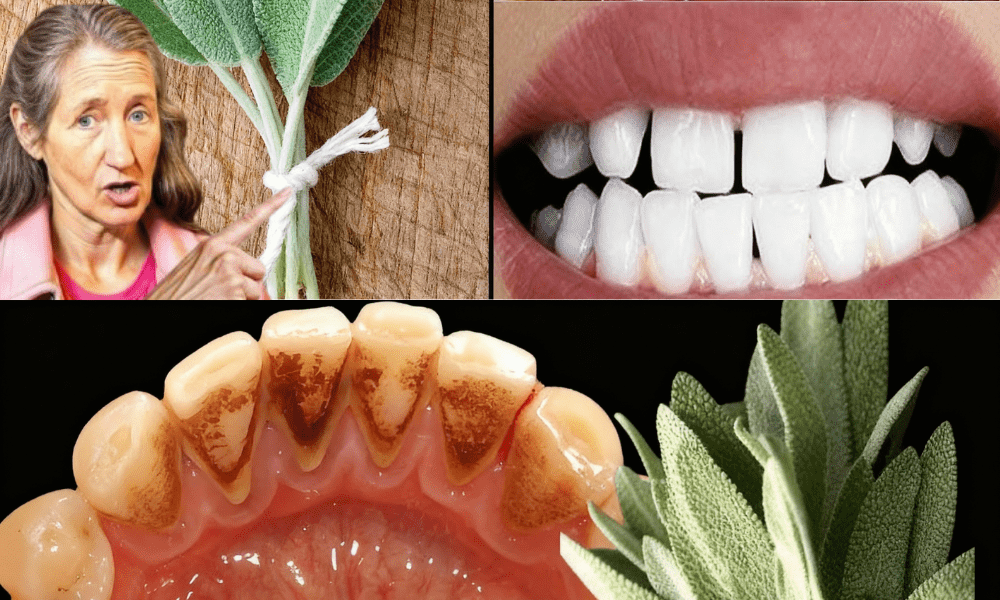 How Sage Leaves Naturally Banish Tartar and Brighten Your Teeth 🌿✨ How Sage Leaves Naturally Banish Tartar and Brighten Your Teeth 🌿✨