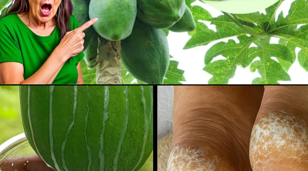 🥭 Heal Cracked Heels Fast: The Astonishing Power of Papaya Sap Revealed 🥭 Heal Cracked Heels Fast: The Astonishing Power of Papaya Sap Revealed