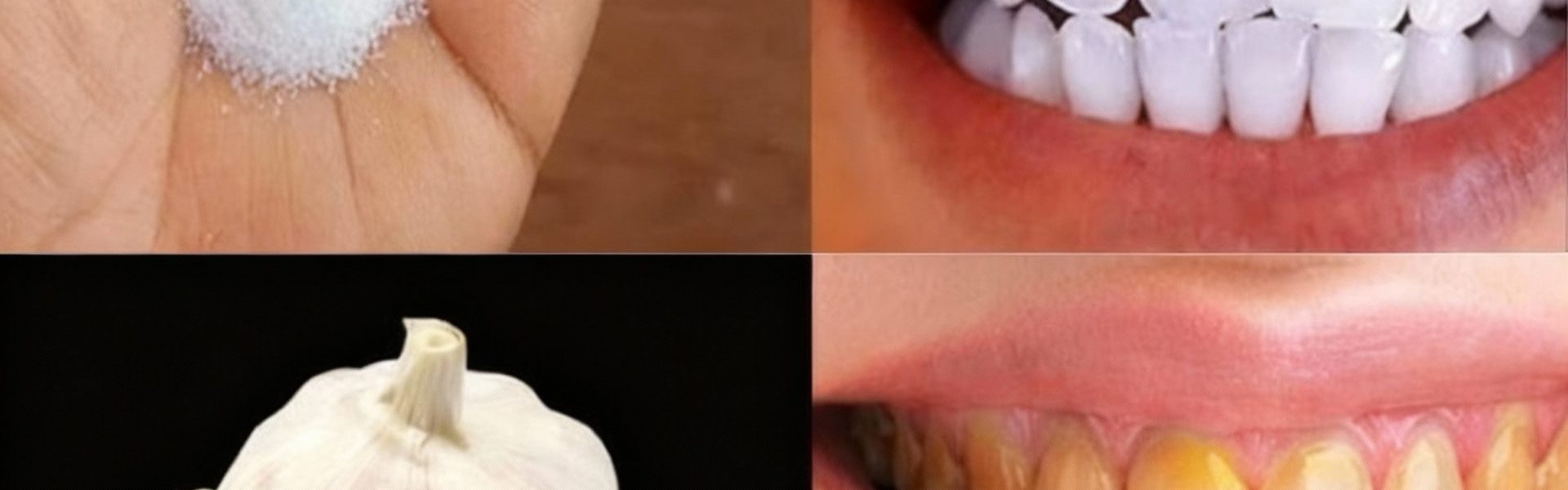 🤯 The Secret Weapon Against Tartar and Gum Disease: Why Dentists Don’t Talk About Garlic A Natural Oral Health Revolution Hiding in Your Kitchen 🤯 The Secret Weapon Against Tartar and Gum Disease: Why Dentists Don’t Talk About Garlic A Natural Oral Health Revolution Hiding in Your Kitchen
