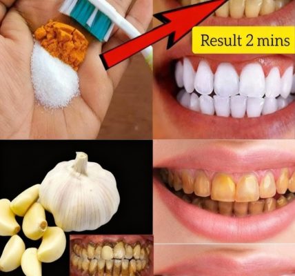 🤯 The Secret Weapon Against Tartar and Gum Disease: Why Dentists Don’t Talk About Garlic A Natural Oral Health Revolution Hiding in Your Kitchen 🤯 The Secret Weapon Against Tartar and Gum Disease: Why Dentists Don’t Talk About Garlic A Natural Oral Health Revolution Hiding in Your Kitchen