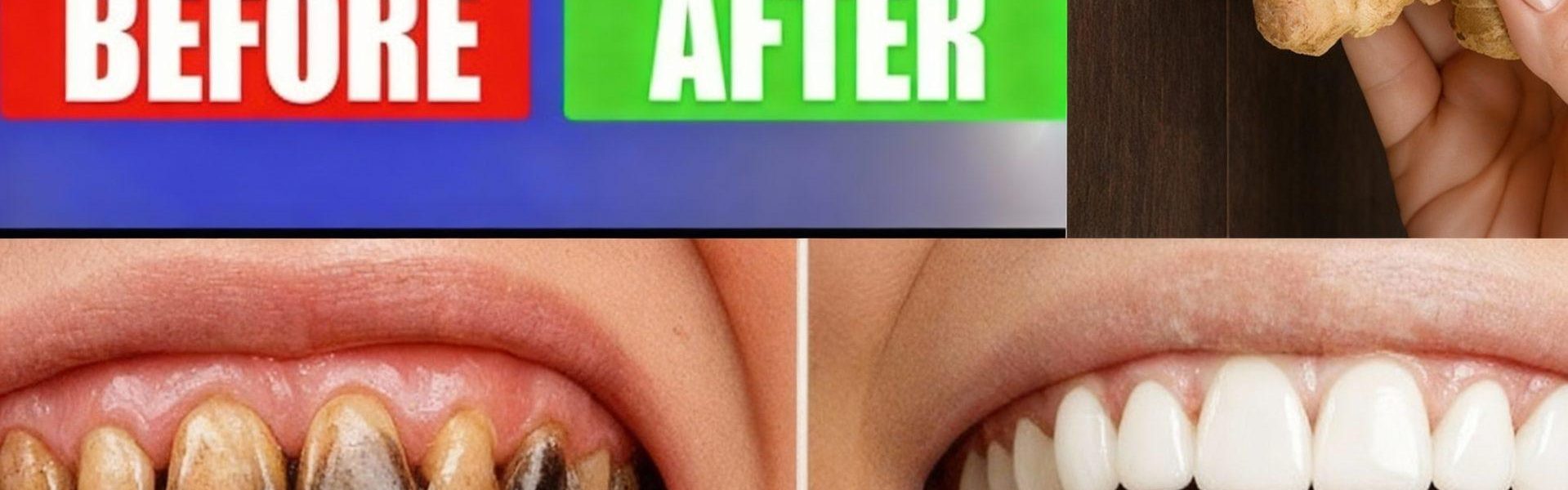 11 Bleach-Free Ways to Whiten Teeth at Any Age 11 Bleach-Free Ways to Whiten Teeth at Any Age
