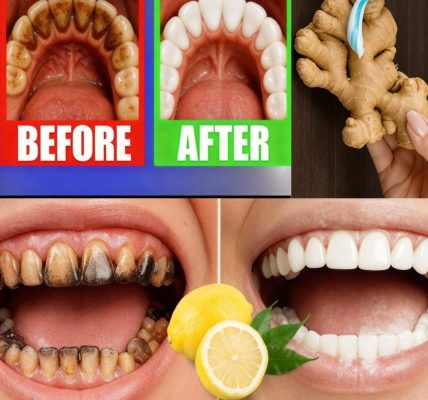 11 Bleach-Free Ways to Whiten Teeth at Any Age 11 Bleach-Free Ways to Whiten Teeth at Any Age