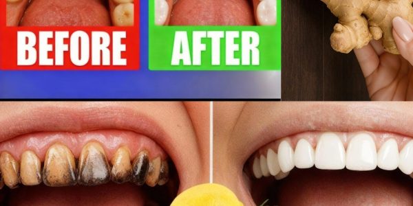 11 Bleach-Free Ways to Whiten Teeth at Any Age 11 Bleach-Free Ways to Whiten Teeth at Any Age
