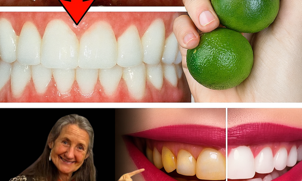 🦷 Flash a Dazzling Smile in Just 1 Minute: The Lemon Secret to Banishing Plaque and Tartar at Home 🦷 Flash a Dazzling Smile in Just 1 Minute: The Lemon Secret to Banishing Plaque and Tartar at Home