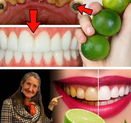 🦷 Flash a Dazzling Smile in Just 1 Minute: The Lemon Secret to Banishing Plaque and Tartar at Home 🦷 Flash a Dazzling Smile in Just 1 Minute: The Lemon Secret to Banishing Plaque and Tartar at Home