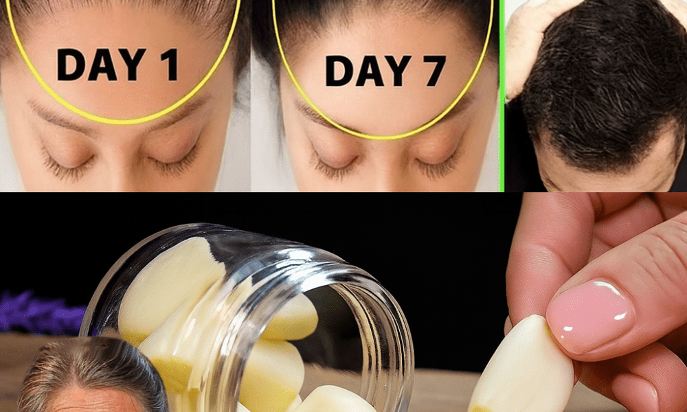 🌟 Transform Your Hair with This 3-Ingredient Natural Miracle Oil 🌟 Transform Your Hair with This 3-Ingredient Natural Miracle Oil