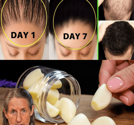 🌟 Transform Your Hair with This 3-Ingredient Natural Miracle Oil 🌟 Transform Your Hair with This 3-Ingredient Natural Miracle Oil