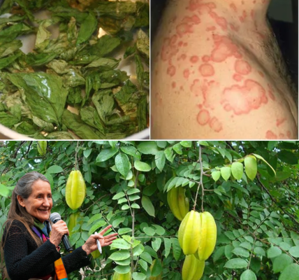 🌿 Star Fruit Leaves Exposed: The Astonishing Remedies for Health and Hives Relief You’ve Been Overlooking 🌿 Star Fruit Leaves Exposed: The Astonishing Remedies for Health and Hives Relief You’ve Been Overlooking