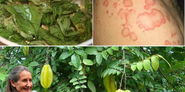 🌿 Star Fruit Leaves Exposed: The Astonishing Remedies for Health and Hives Relief You’ve Been Overlooking